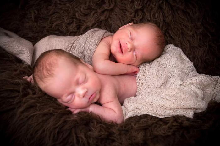 Pre existing heart condition and pregnant with twins. Twins born 33 weeks and 5 days. pregnant with twins with a preexisting heart condition