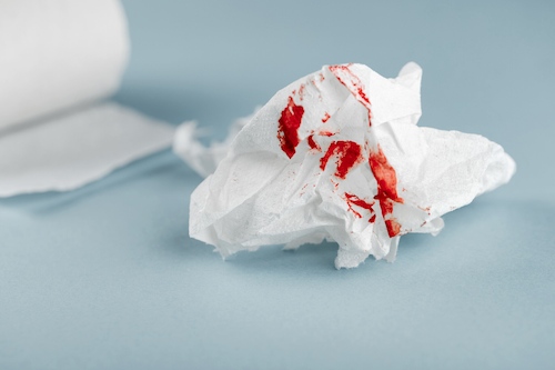 constipation in twin pregnancy