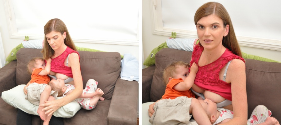 Desmoid Tumour after twin pregnancy. twins and desmoid tumour
