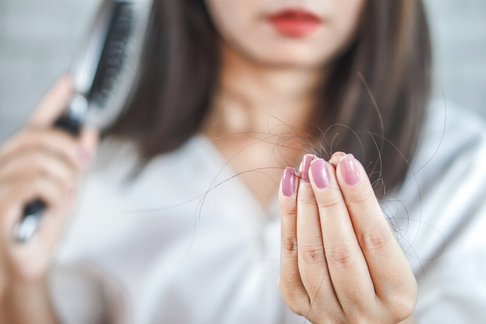 Post-partum hair loss after twins or triplets Post-partum hair loss after twins or triplets