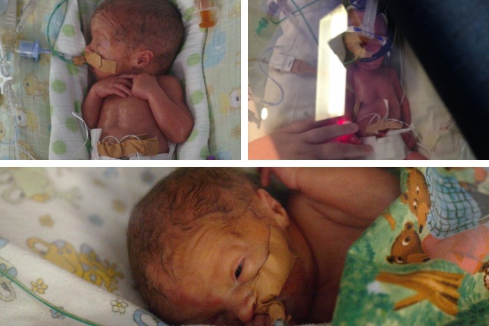 Triplets born at 27 weeks 27 week triplets