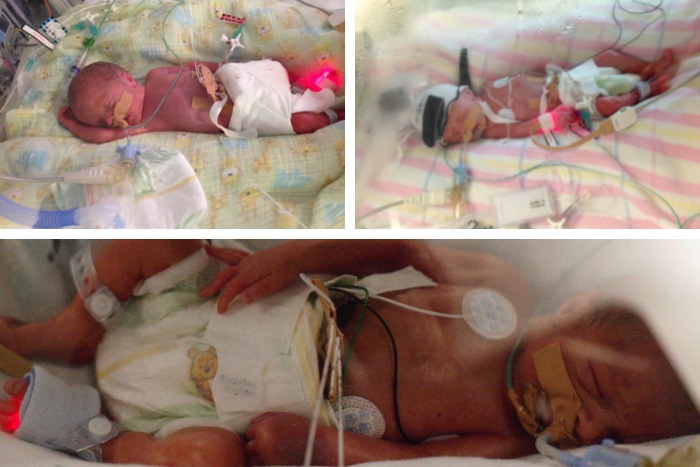 Triplets born at 27 weeks babies born at 27 weeks