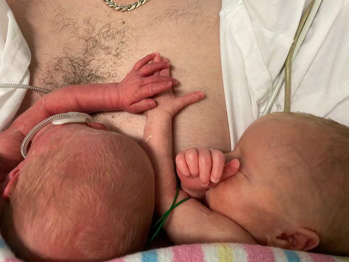 Possible TTTS, TAPS, preeclampsia, HELLP Syndrome and twins possible TTTS twins