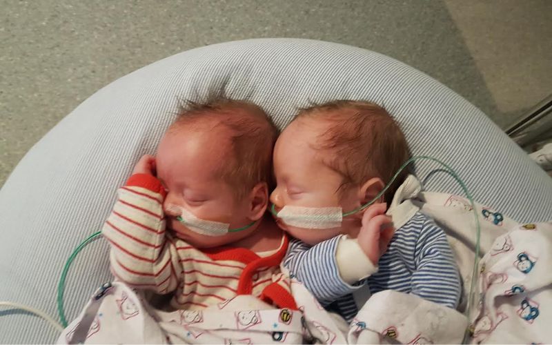 Triplets (with surviving fraternal boy twins) born at 29+4 Triplets: twins survived
