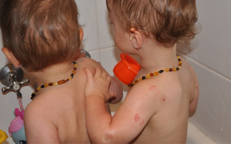 Twins who bite: Biting, and how to minimise it How to stop twins biting each other