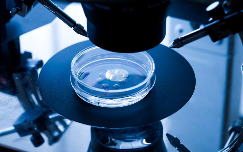 IVF baby