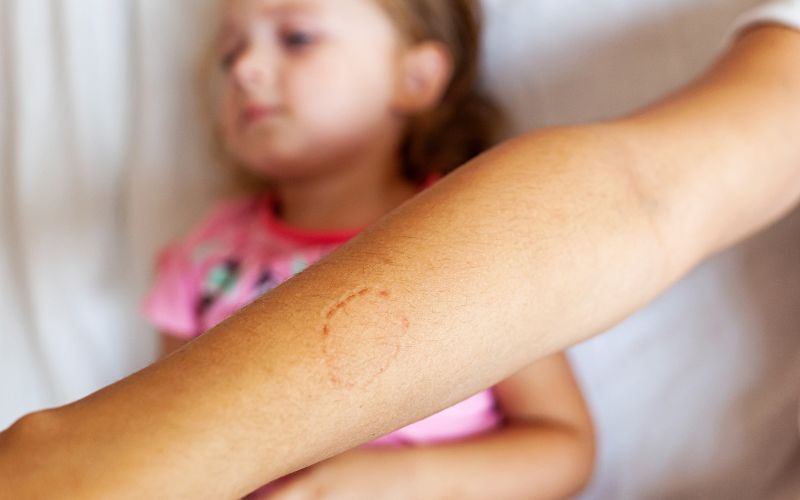 Twins who bite: Biting, and how to minimise it Twins who bite