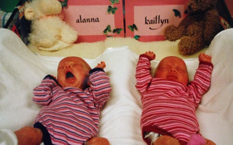 Fraternal girls twins - born at 31+6 fraternal girl twins born at 31 weeks