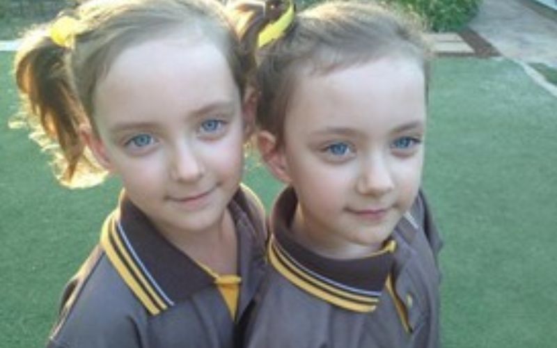 MoMo twins born at 32 weeks monoamniotic 5 years old