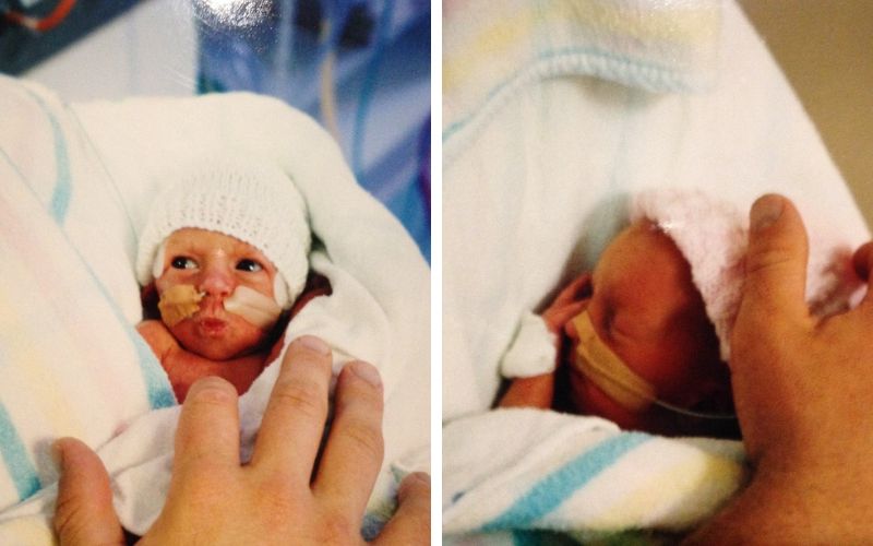 Fraternal girls twins - born at 31+6 outlook for twins born at 31 weeks