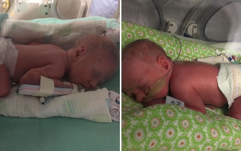 32 week twins