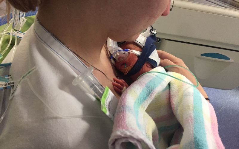 Born at 28 weeks - Twin Birth Story Born at 28 weeks Twin Birth