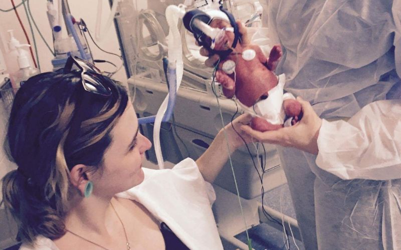 Born at 28 weeks - Twin Birth Story Born at 28 weeks
