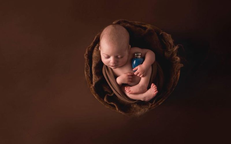 TTTS and TAPS birth story – And the loss of one twin TTTS and TAPS birth story – The birth of my twins