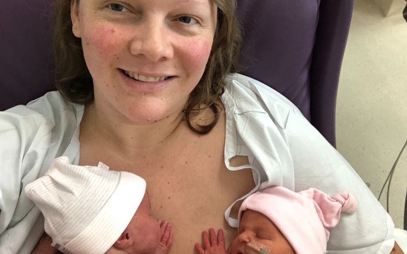 Twins born at 32 weeks 2 days due to placental abruption Twins born at 32 weeks 2 days due to placental abruption