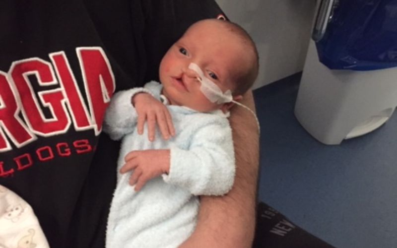 Surprised by a cleft lip and palate in one twin at birth cleft lip and palate in one twin