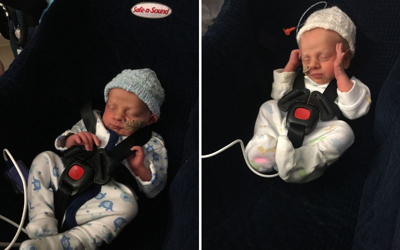 transfering twins between hospitals