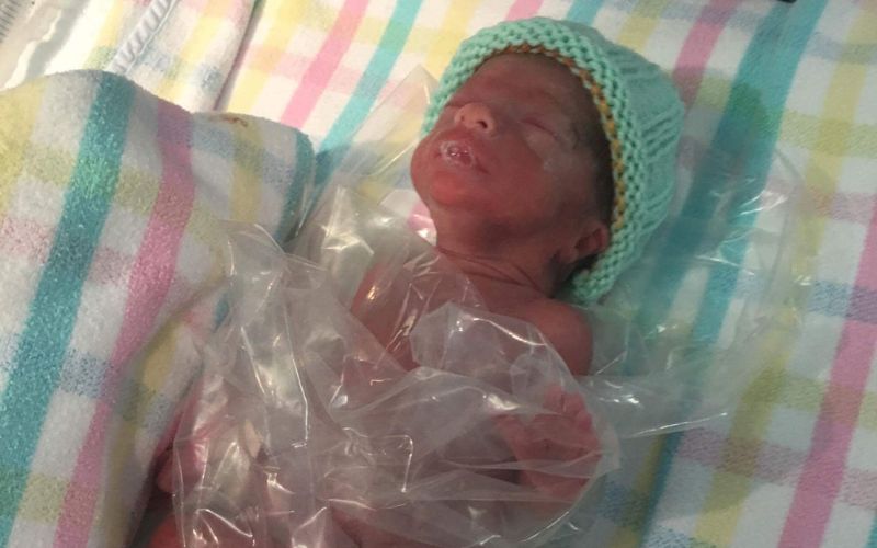 Born at 28 weeks - Twin Birth Story twins born 28 weeks