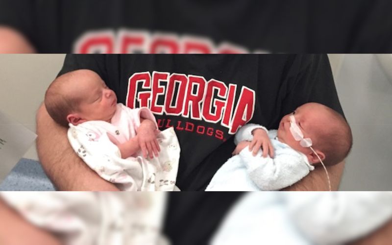 Surprised by a cleft lip and palate in one twin at birth twins born at 36 weeks