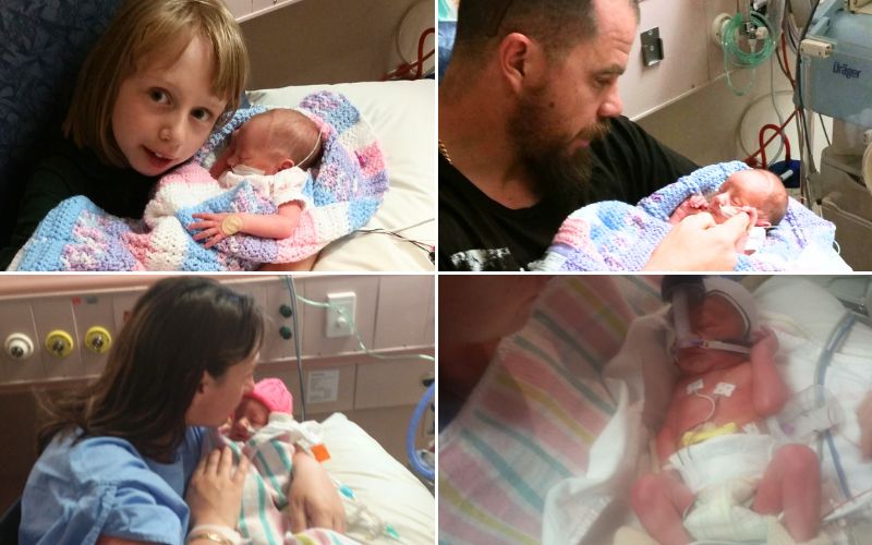 DCDA twins born at 32 weeks