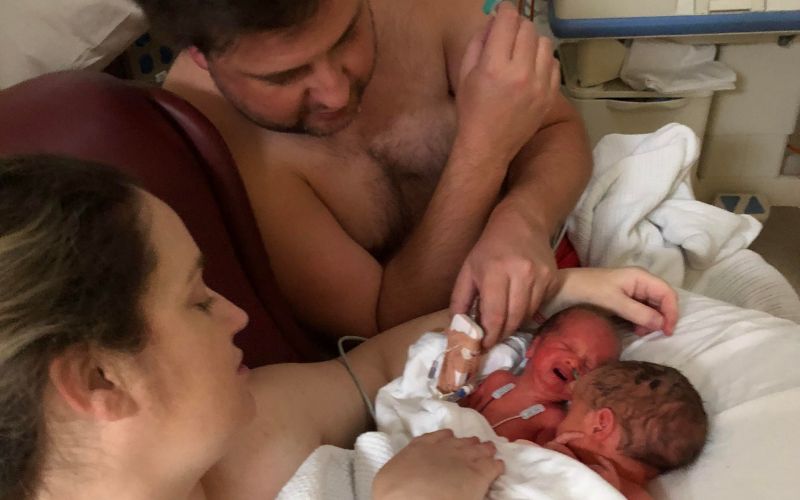 Increased umbilical cord pressure for one twin