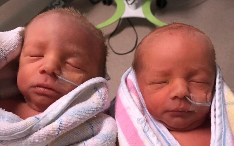 Laser ablation surgery success story | Twin To Twin Transfusion Syndrome Laser ablation surgery success story Twin To Twin Transfusion Syndrome