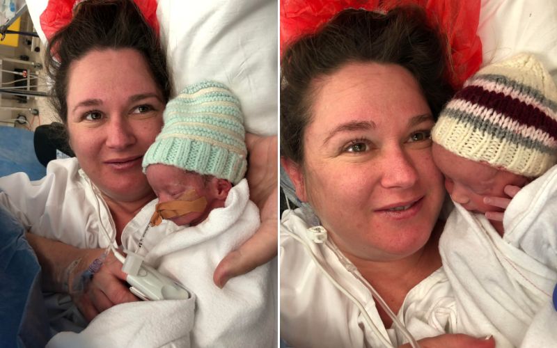 Twins Increased umbilical cord pressure