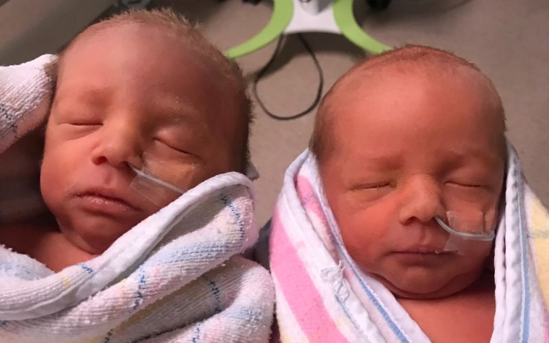 Laser ablation surgery success story | Twin To Twin Transfusion Syndrome laser ablation success story