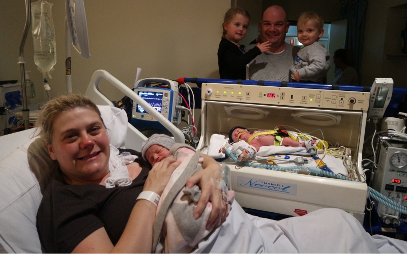 One of our twins was born with a Congenital Diaphragmatic Hernia. twins Congenital Diaphragmatic Hernia and twins