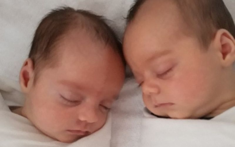 caesarean twin birth born at 36 weeks