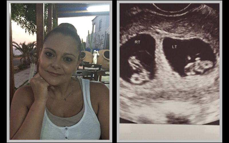 Our miracle twins were conceived with donor eggs greek donor eggs