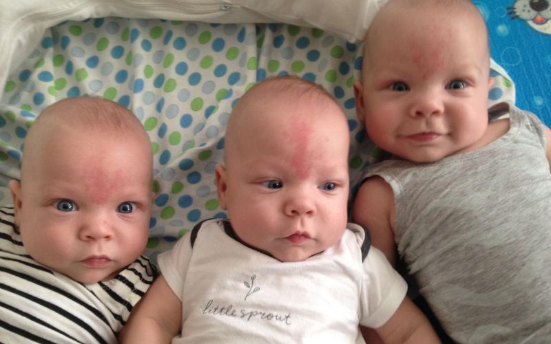 Finding out we were pregnant with identical triplets pregnant with identical triplet boys