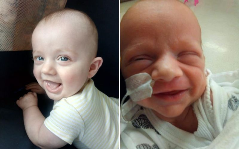 Full placenta abruption with twins. My harrowing twin birth story. severe bleeding when pregnant with twins