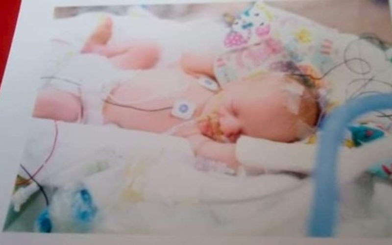Full placenta abruption with twins. My harrowing twin birth story. twin born early due to placenta abruption