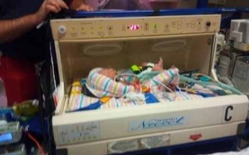 Full placenta abruption with twins. My harrowing twin birth story. twins and full placental abruption