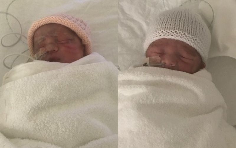 Twin pregnancy and an unexpected diagnosis twins born at 34+5