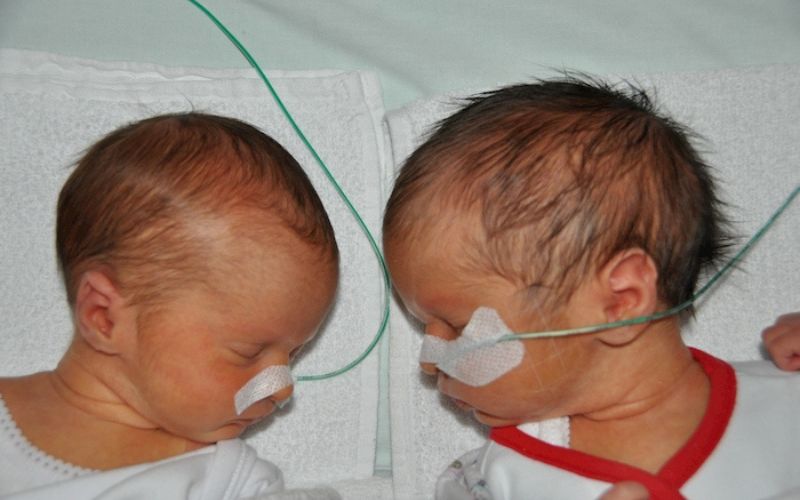 Twins in the Special Care Nursery. My experience. twins special care