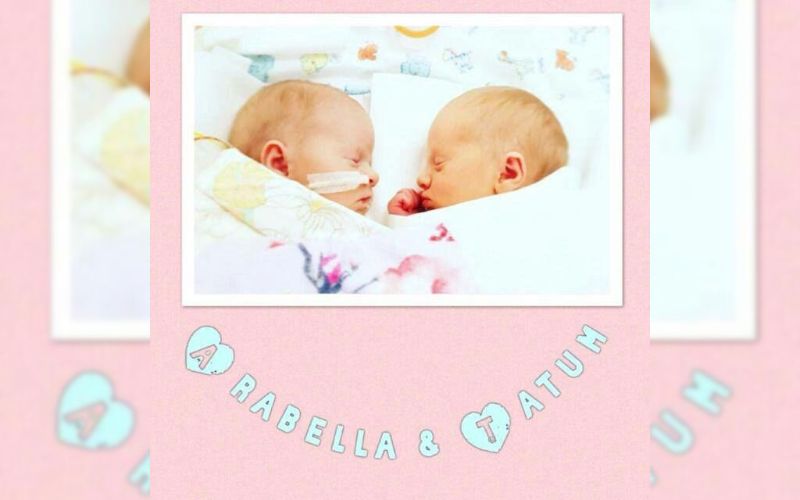 Congenital heart defect in one twin