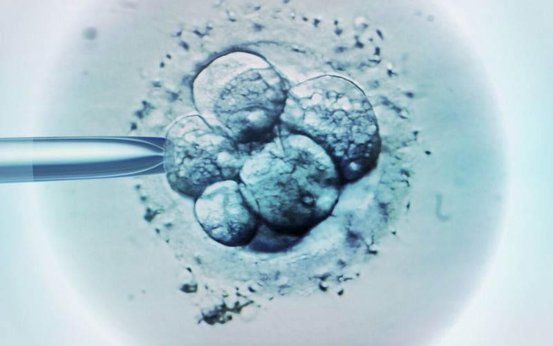 IVF identical Twins | The Roller-coaster of Infertility IVF process and twins