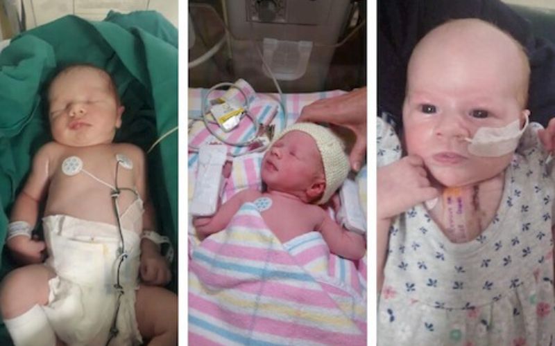 Taking only one twin home from hospital