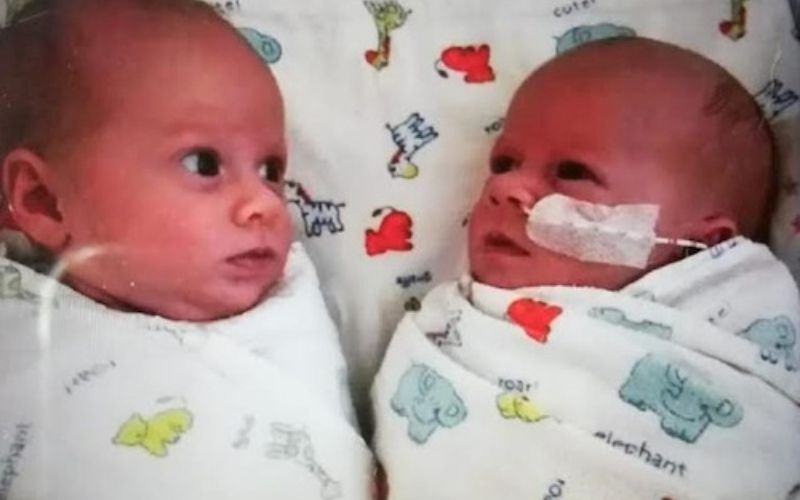congenital heart defect in twins