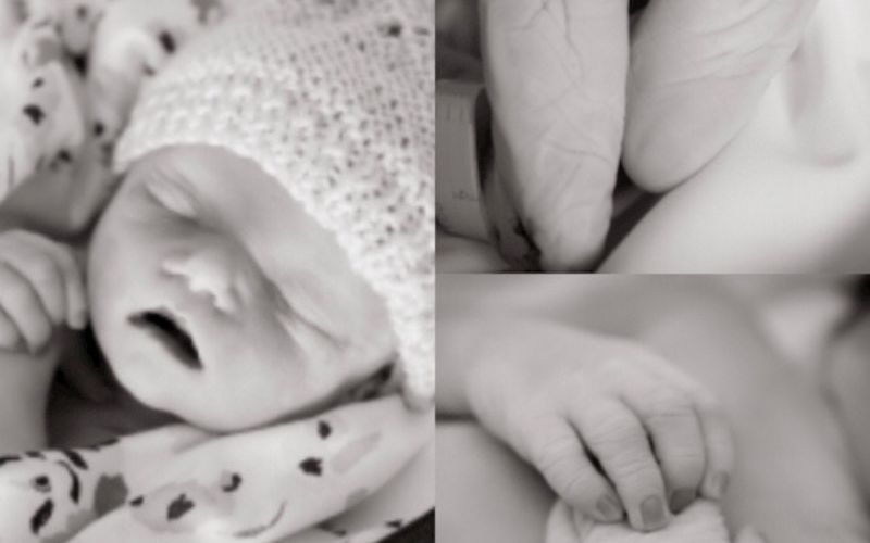 death of a twin at 37 weeks