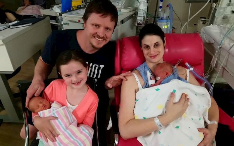 open heart surgery in twins