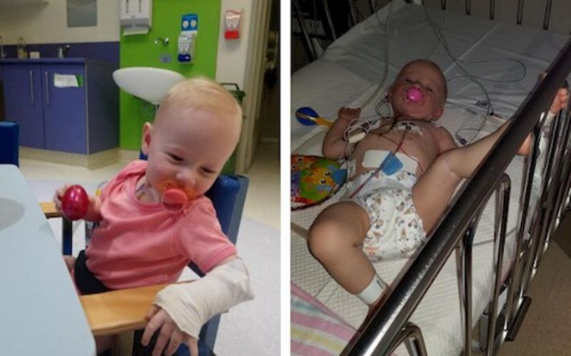 pulmonary atresia in twins