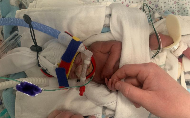 Twins born on different days. Twins born four days apart have different star signs. twins born at 25 weeks Australia