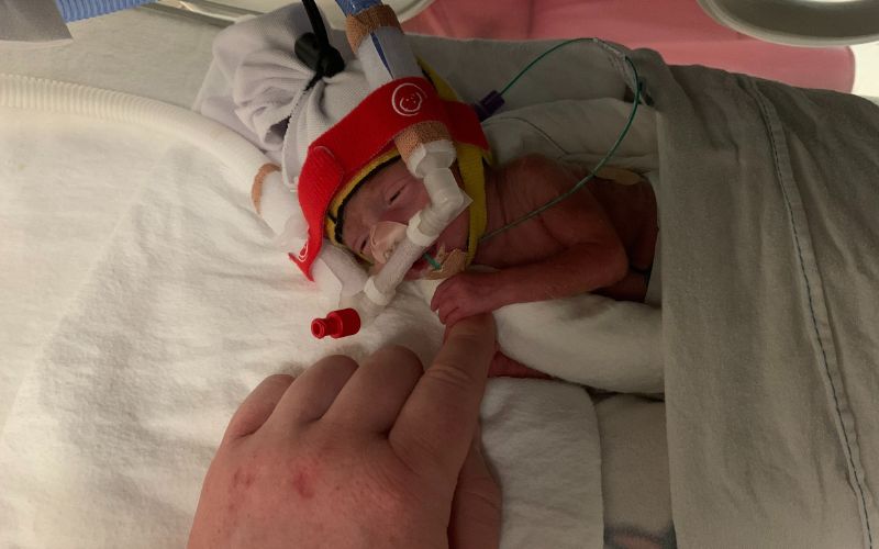 Twins born on different days. Twins born four days apart have different star signs. twins born at 25 weeks