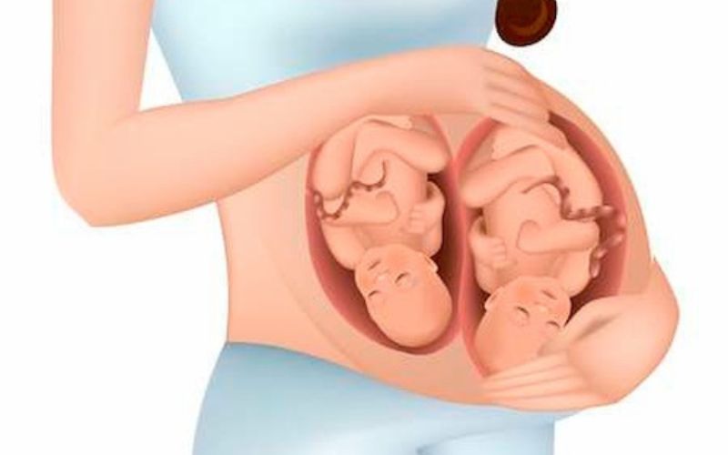Could my twins be identical? Twin Zygosity are my twins identical or fraternal