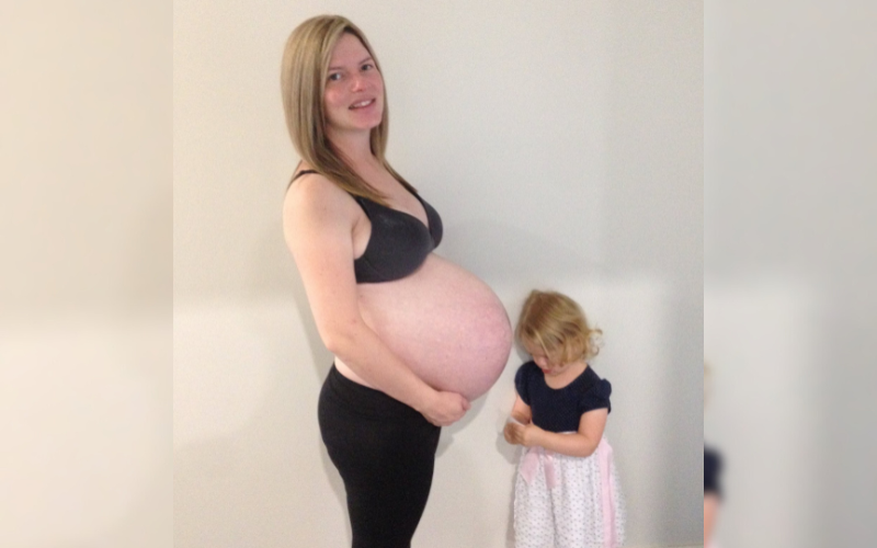 epidural and twin birth