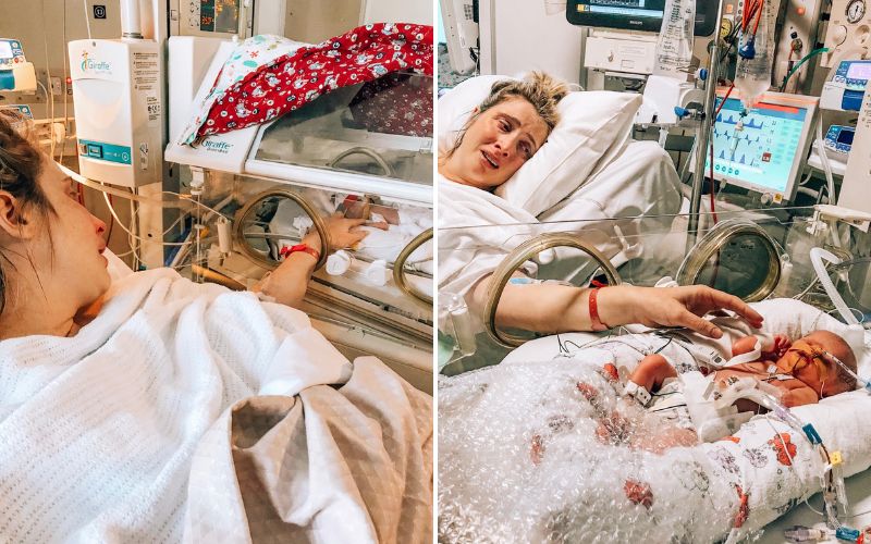 MCDA Twins born at 29 weeks